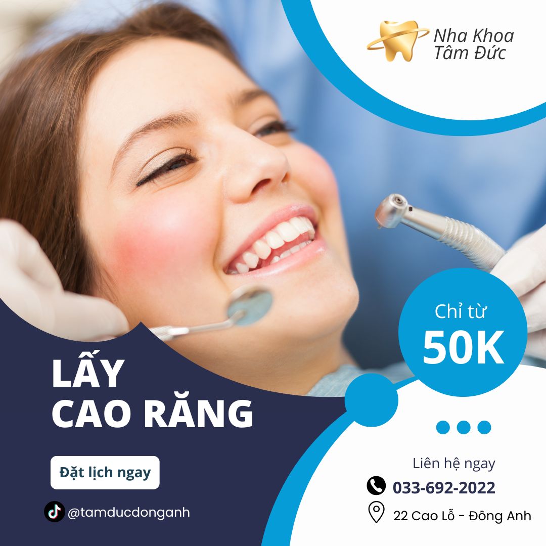 Lấy Cao Răng